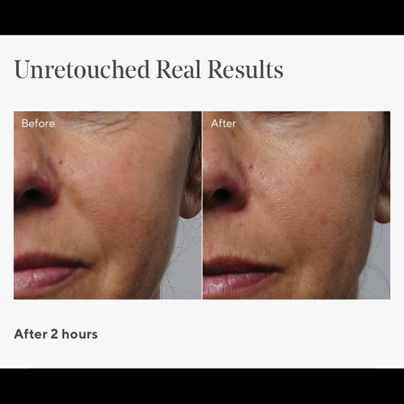 Murad Resurgence Renewing Steps 1, 2 & 3 - Picture 3 of 8